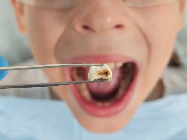 Best Pediatric Emergency Dentist in Stanhope, NJ